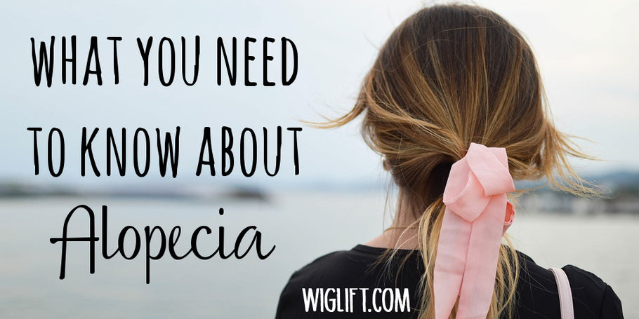 What You Need To Know About Alopecia
